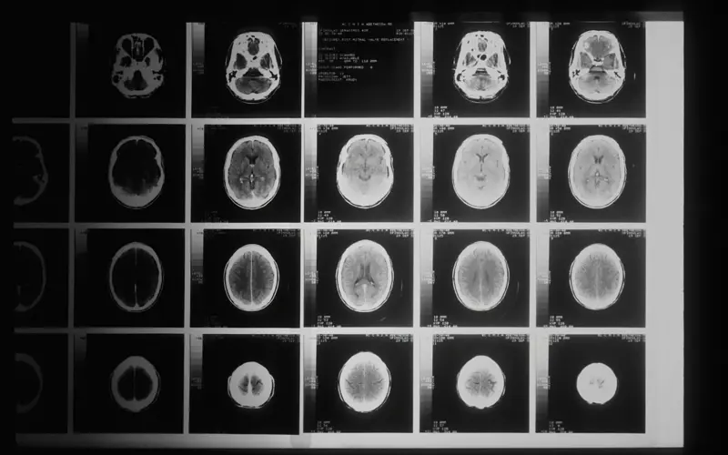 CAT scan imaging data from the National Cancer Institute