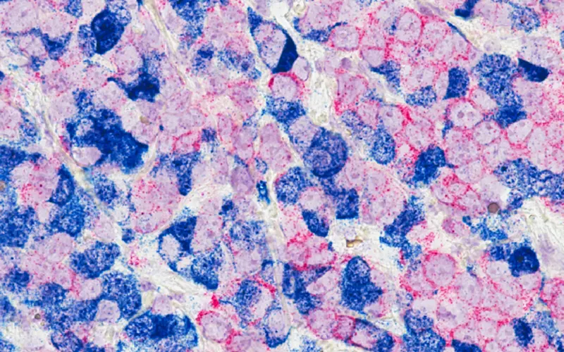 Breast Cancer Cells National Cancer Institute