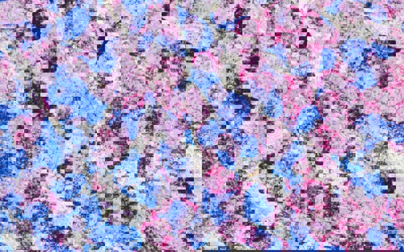 Breast Cancer Cells National Cancer Institute