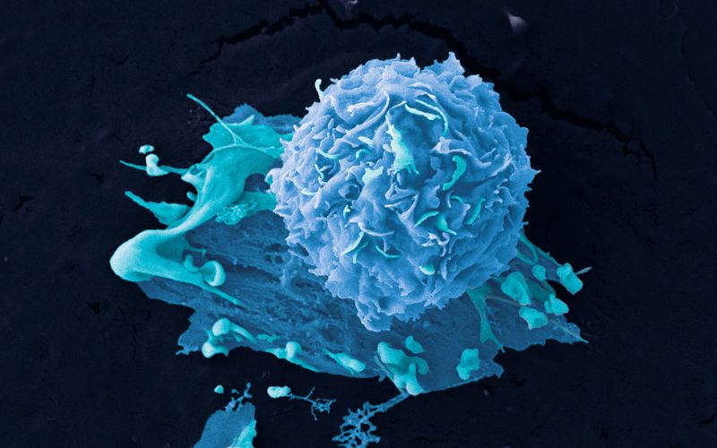 Breast Cancer Cells