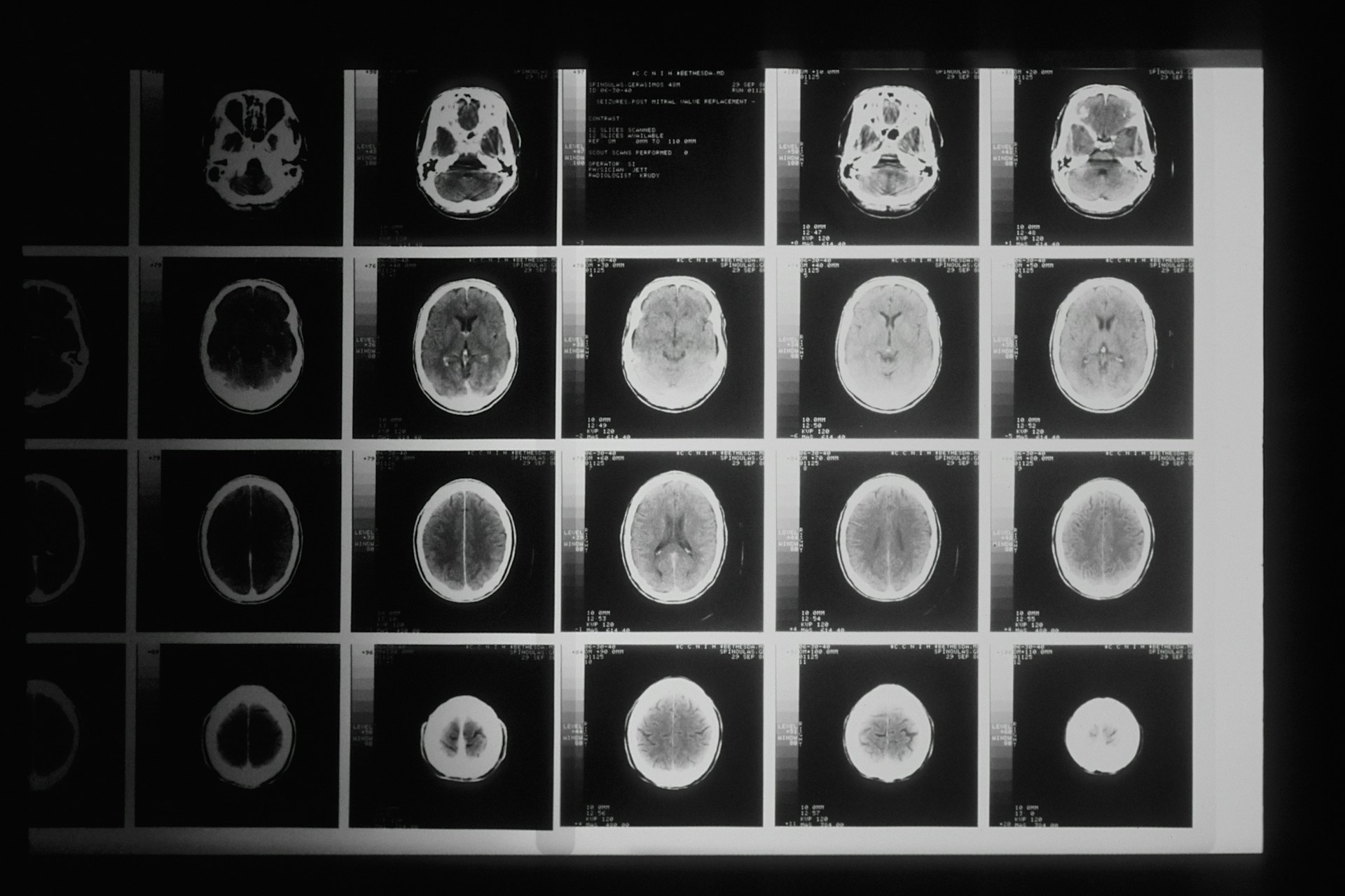 Black and white brain scans