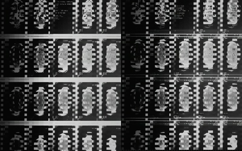 Black and white brain scans