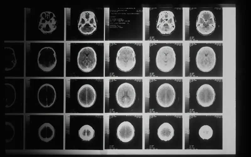 Black and white brain scans