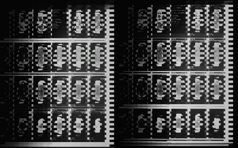 Black and white brain scans